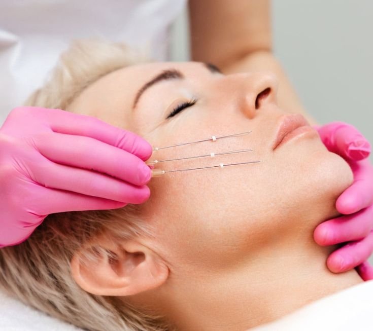Full Face Threading