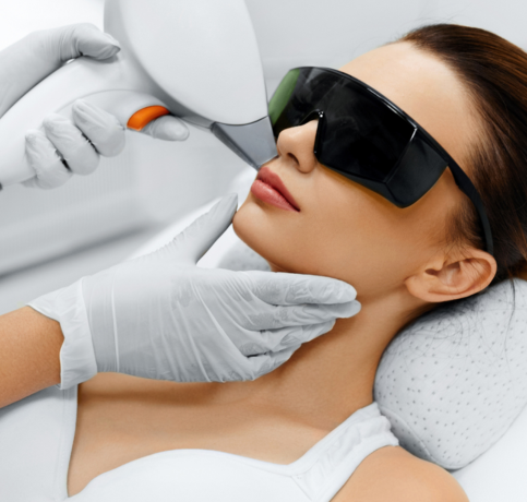 Laser Hair Removal