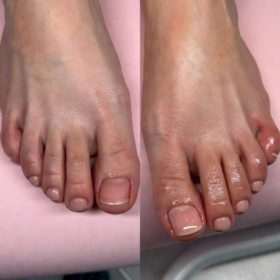 Pedicure before and after Luton — smooth beautiful feet result at MS Beauty Salon